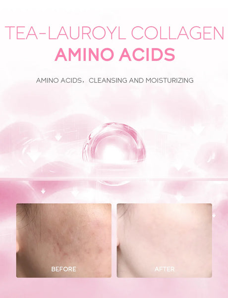 Japanese Cherry Blossom or Vitamin C Facial Cleanser Skin Cleansing Moisturizing Blackhead Remove Skincare Face Wash Foam Face