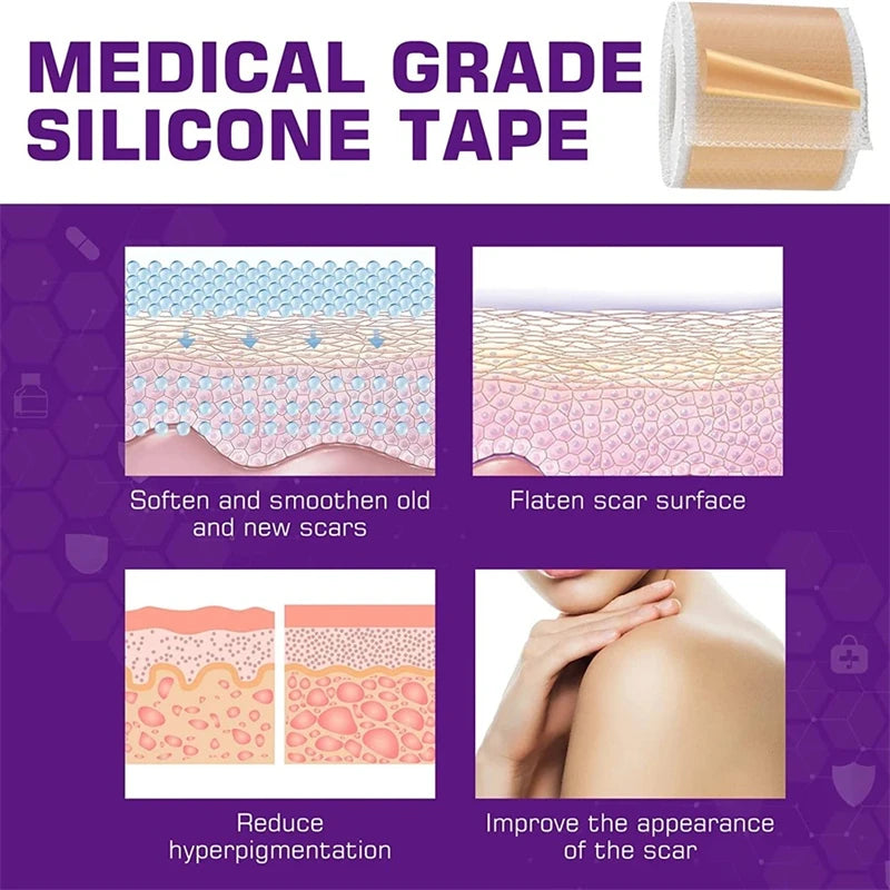 Silicone Scar Sheets - Reusable Scar Tape for Keloid, C-Section, Surgery, Burn, Acne - Waterproof, Hypoallergenic, Latex-Free