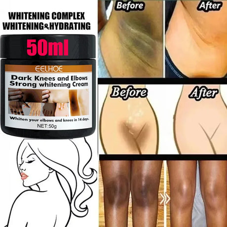 Body Whitening Cream Private Parts Underarm Bleaching Serum Whiten Butt Knee Brighten Inner Thigh Intimate Dark Remove Melanin