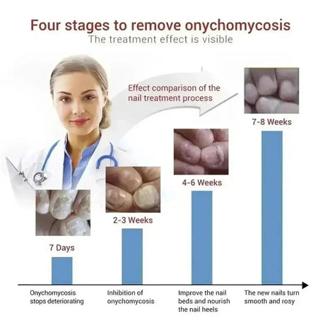 7 Days Nail Fungus Treatment Serum Ginger Anti-infective Paronychia Onychomycosis Toe Foot Nail Fungal Repair Gel Hand Foot Care
