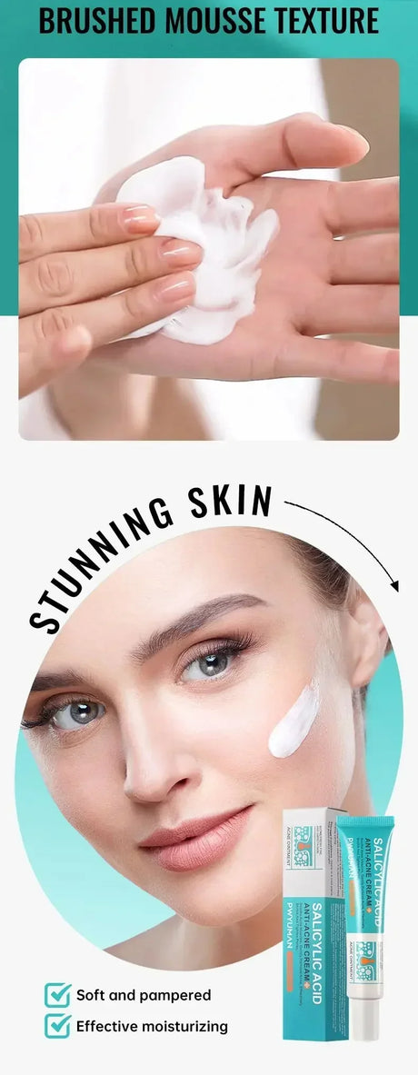 Salicylic Acid Acne Treatment Face Cream Repair Pimple Spots Deep Cleaning Pore Anti-acne Scar Oil Control Moisturizer Skin Care