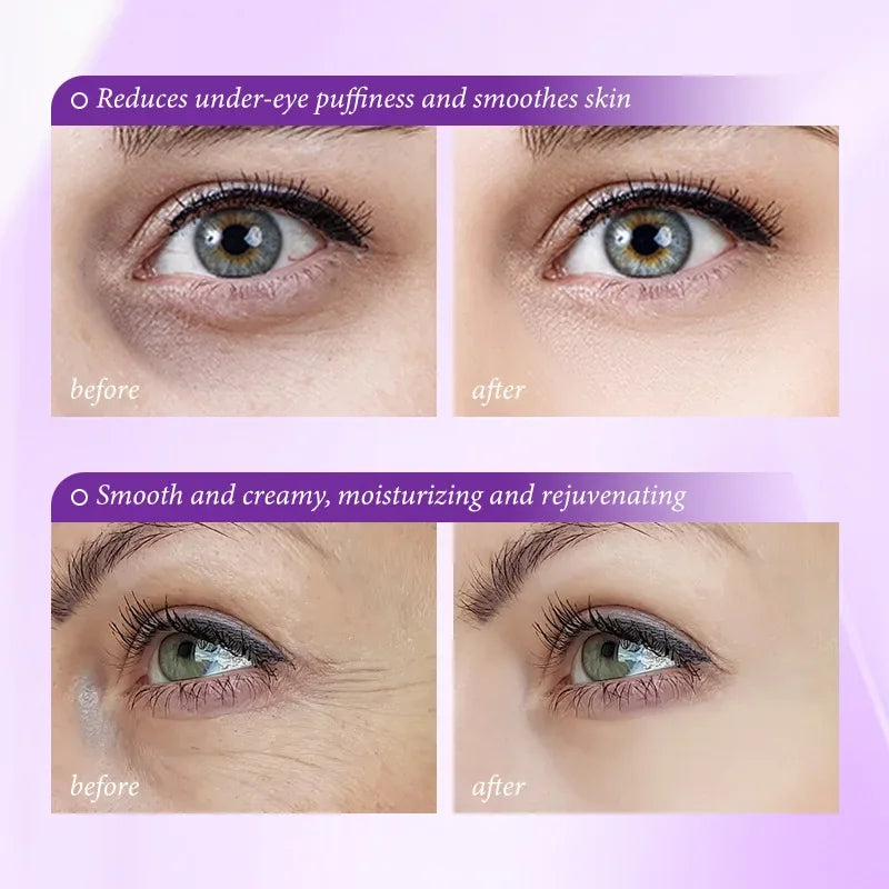 Instant Eye Bag Removal Cream Retinol Anti-Wrinkle Firming Skin Fade Fine Lines Anti Dark Circle Puffiness Brighten Eye Skincare