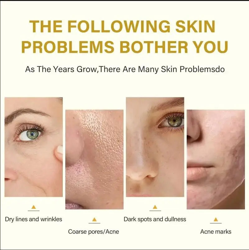 High Quality 50% Chemical Peel Acid Skin Superforce Pigmentation Lightening Melanin Acne Treatment Remove Scar