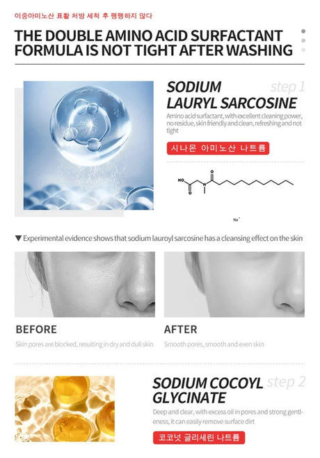 Dark Spots Remover Whitening Serum Face Freckle Melanin Correcting Reduce Fine Lines Brighten Essence Korean Beauty Skin Care
