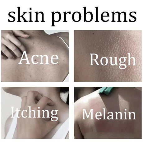 Body Whitening Soap Deep Skin Bleaching Brighten Body Scrub Knees Intimate Parts Armpits White Nourishing Care Soap