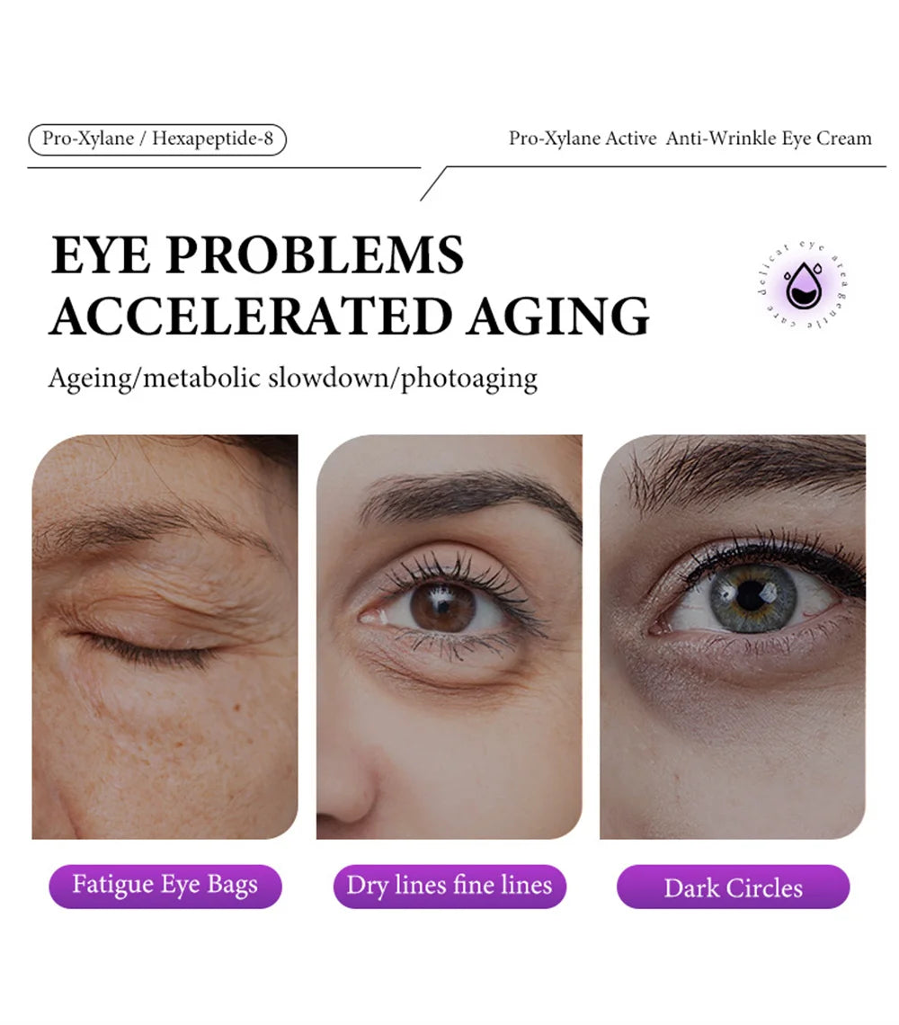 Instant Eye Bag Removal Cream Collagen Anti-Wrinkle Fade Fine Lines Firming Skin Anti Dark Circle Puffiness Brighten Eye Care
