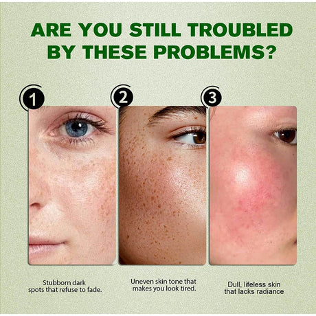Dark Spot Correcting Glow Serum,Dullness,Acne,And Melanin Remover,Niacinamide Facial Skin Moisturizing Brightening Skincare
