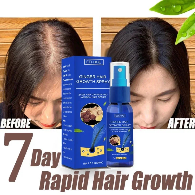 Ginger Hair Growth spray Anti Fall Loss Treatment Essence Oil for Men Women hair treatment