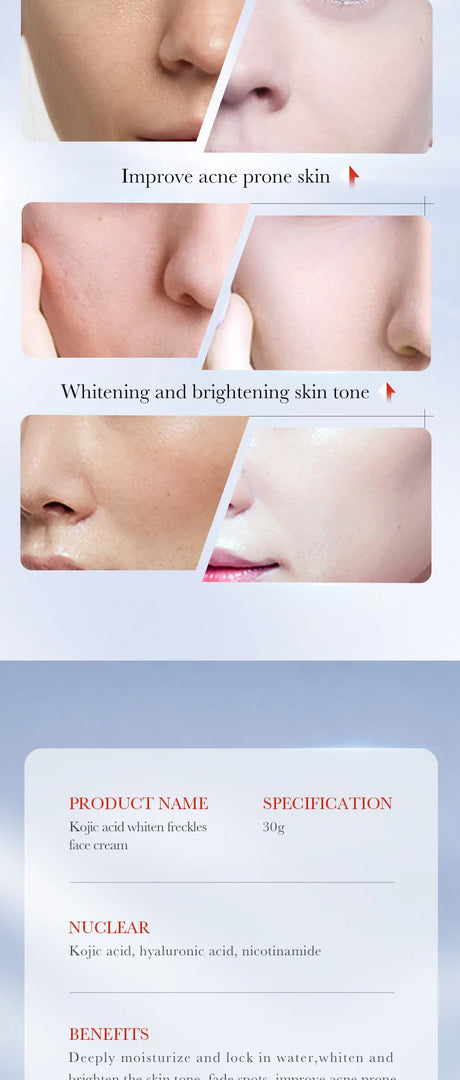 SADOER Kojic Acid Skin Care Sets Moisturizing Freckle Removing Face Cream Anti Dark Circles Eye Cream Travel Size Skin Care