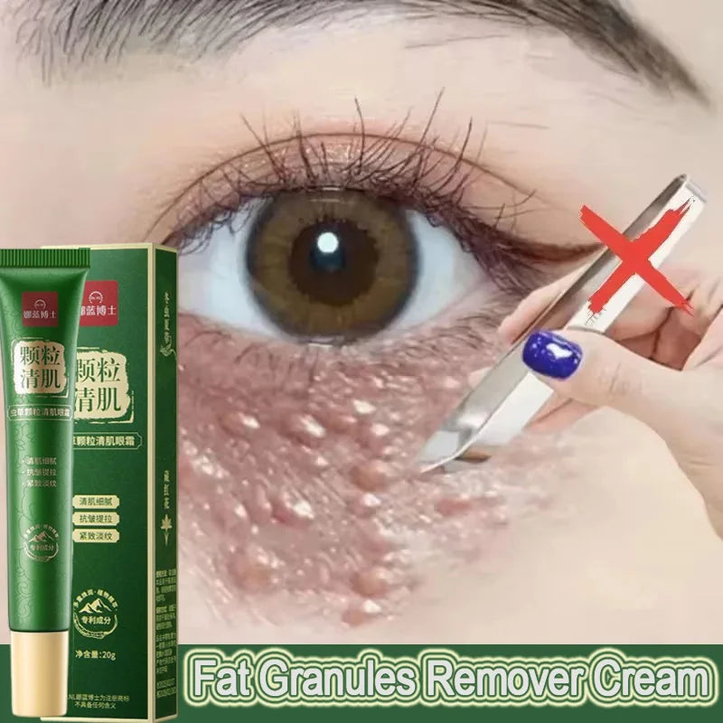 Fat Granules Remover Eye Cream Anti-Puffiness Anti Inflammatory Reduce Dark Circles Eyebags Fade Lines Moisturizing Eye Care