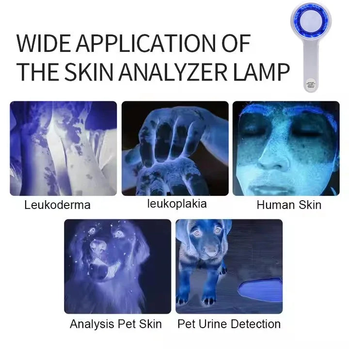 NEW Professional Dermatoscope Skin Medical Magnifier Detection Woods Lamp UVA Lamp For Vitiligo Detection