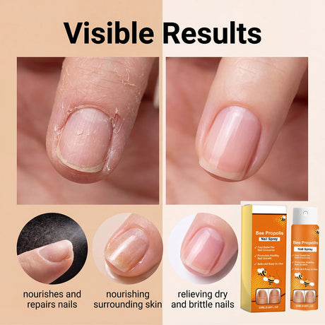 Bee Venom Nail Soothing Spray Nail Repair Treatment for Damaged&Discolored Toenail Moisturizing Nourishing Care for Brittle Nail