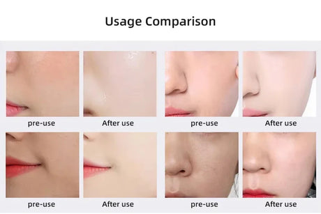 New Design - Portable CO2 Oxygen Bubble Pen Rechargeable Exfoliate Device Handheld Facial Clean Machine SPA Beauty Capsules
