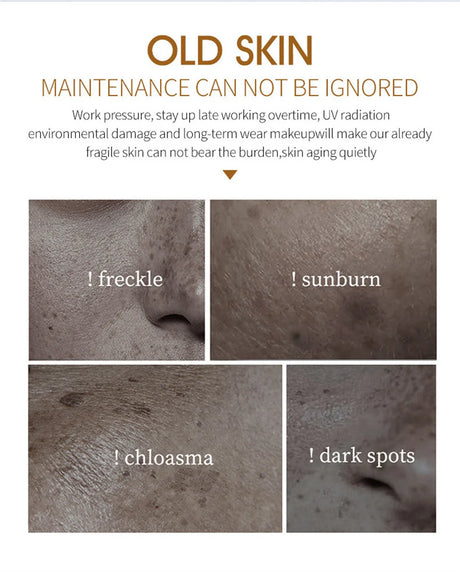 Powerful Spot-Removing Whiten Cream Brighten Skin Fast Eliminates Melanin Pigmentation Melasma Dark Spots Korean Face Skin Care