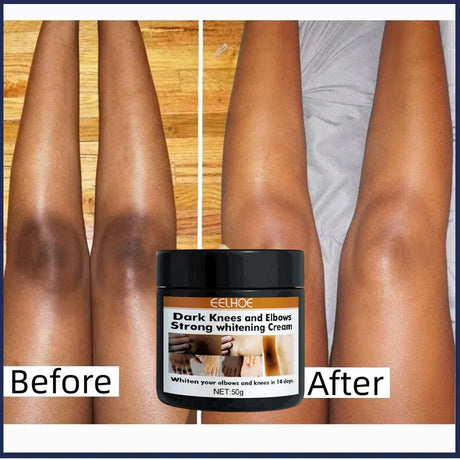 Body Whitening Cream Private Parts Underarm Bleaching Serum Whiten Butt Knee Brighten Inner Thigh Intimate Dark Remove Melanin