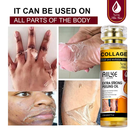 AILKE Collagen Yellow Peeling Oil For All Skin Types, Stretch Mark Removal, Lightening , Improve Rough Skin, Gentle Exfoliation
