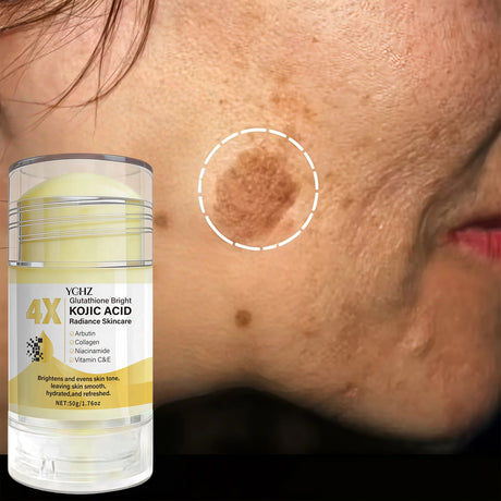 Kojic Acid Cream Stick, Evens Out Skin Tone, Eliminates Dark Spots and Dullness - Non-Greasy, Suitable for Both Men and Women - Whitening and Moisturizing Cream, for Day and Night Use - 50g