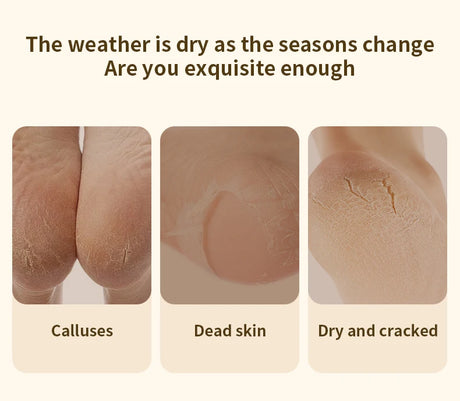 HOMEFISH Electric Foot Grinder Automatic Foot Callus Rubbing Pedicure Dead Skin Callus Remover for Foot Beauty Machine
