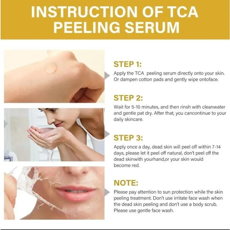 High Quality 50% Chemical Peel Acid Skin Superforce Pigmentation Lightening Melanin Acne Treatment Remove Scar