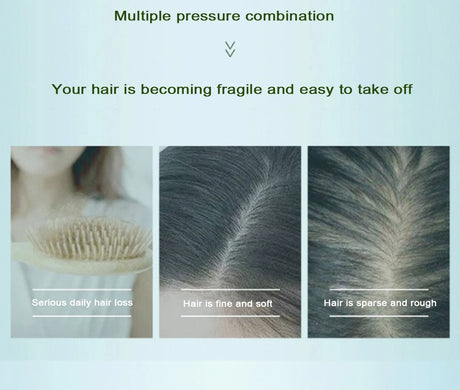 Zhangguang 101Hair Thickening Shedding proof Oil Control Shampoo 500g Firming Root Thick Smooth Against Anti Hair Loss Shampoo