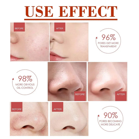 Pore Shrink Face Serum Remove Blackheads Acne Acidity Oil Control Repair Essence Moisturizing Nourish Pores Firming Facial Care
