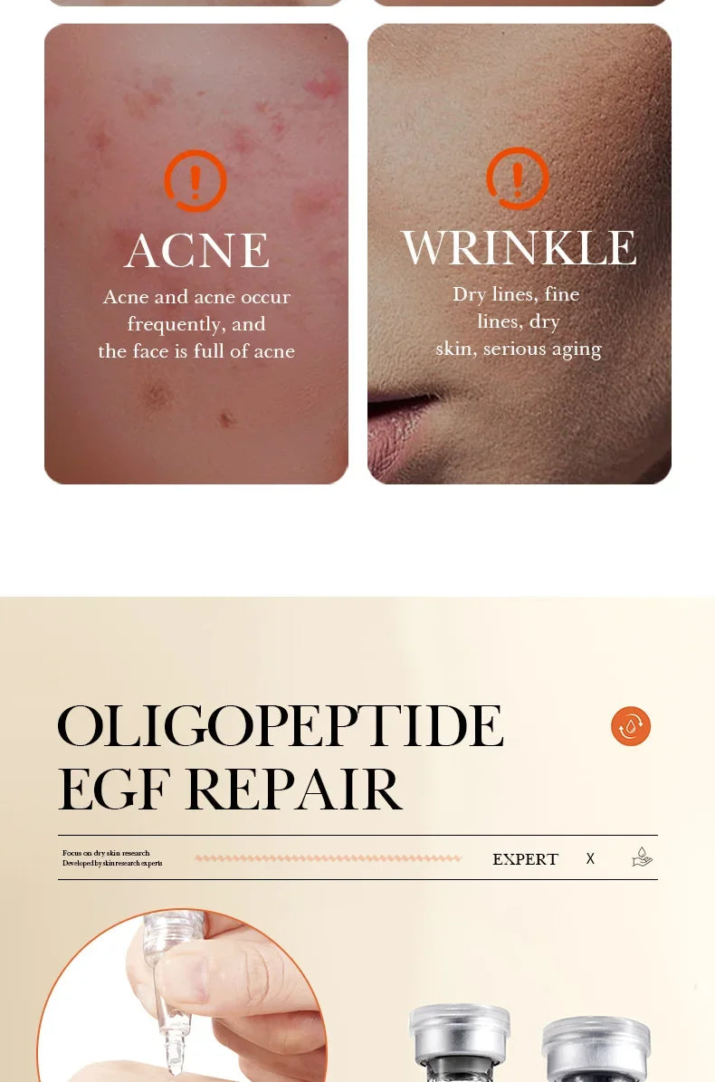 BIOAOUA Oligopeptide Face Skin Repair Freeze-dried Powder Set Sensitive Skin Moisturizing and Smoothing Hyaluronic Acid Essence