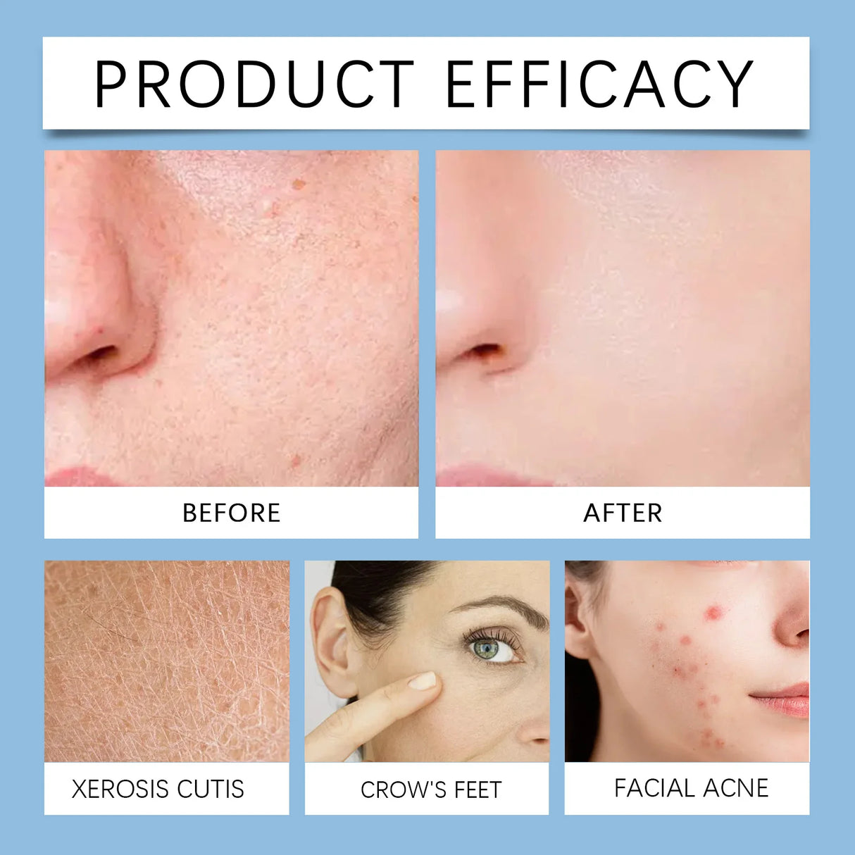 Salicylic Acid Acne-Clearing Toner Pads,Dual Action Exfoliation,Deep Clear Acne&Refine Pores,Centella+Allantoin,Soothing&Anti Redness,Polish Strawberry Nose&Rough Texture,Hydrating&Non-tightening,Convenient Dual Textured Pads