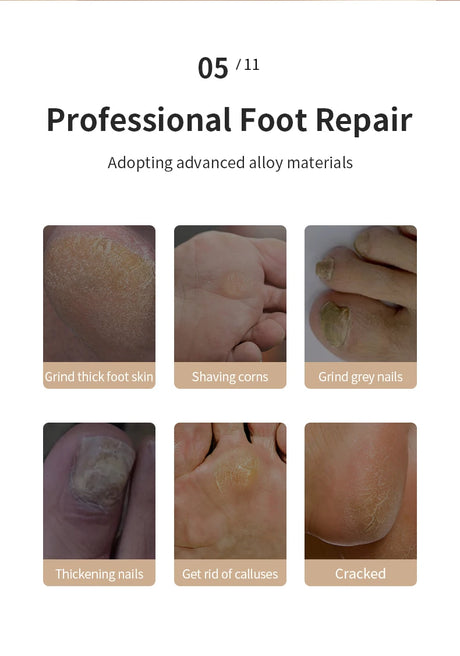 HOMEFISH Electric Foot Grinder Automatic Foot Callus Rubbing Pedicure Dead Skin Callus Remover for Foot Beauty Machine