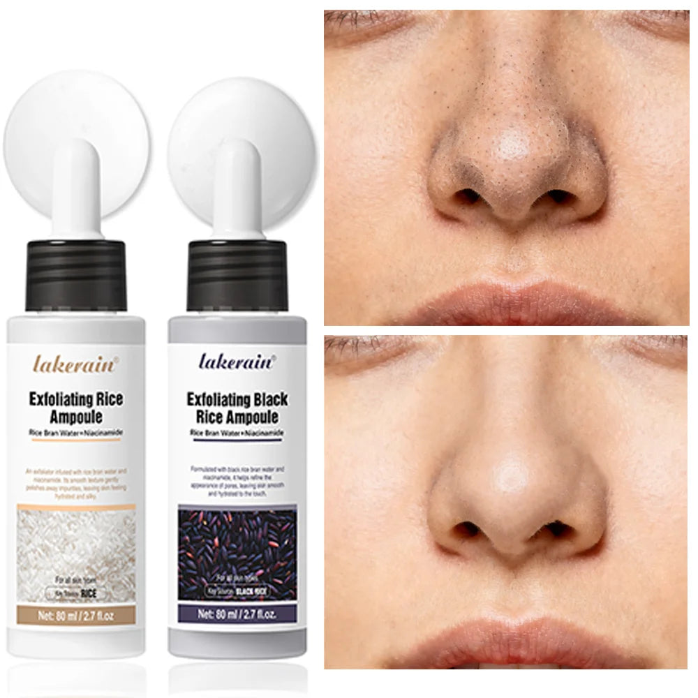 Rice Peeling Ampoule Soft Exfoliating Face and Body Scrub Dead Skin Cells Blackhead Remover for All Skin Types korean skin care