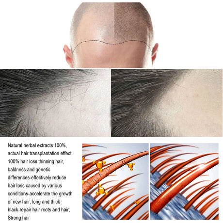 Hair Care Spray Ginger Massage Scalp Improve Dry Damaged Serum Smooth Nourish Repair Roots Anti Hair Loss Essence For Men Women