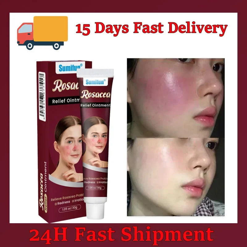 Repair Facial Redness Cream Instant Spider Vein Remove Sensitive Skin Sooth Anti Redness Rosacea Treat Lotion Korean Cosmetics