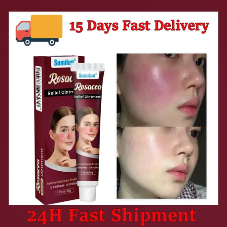 Repair Facial Redness Cream Instant Spider Vein Remove Sensitive Skin Sooth Anti Redness Rosacea Treat Lotion Korean Cosmetics