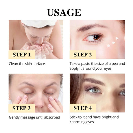Fat Granules Remover Eye Cream Anti-Puffiness Anti Inflammatory Reduce Dark Circles Eyebags Fade Lines Moisturizing Eye Care
