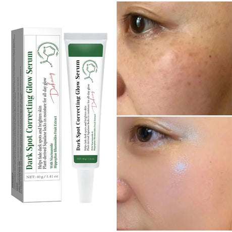 Dark Spot Correcting Glow Serum,Dullness,Acne,And Melanin Remover,Niacinamide Facial Skin Moisturizing Brightening Skincare