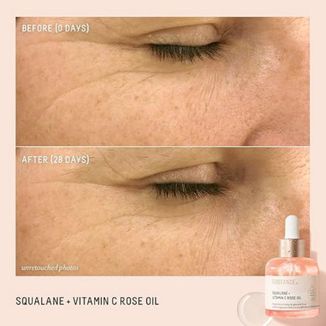 Squalane + Vitamin C Rose Advanced Facial Oil - Brightening, Firming, and Hydrating Serum for All Skin Types