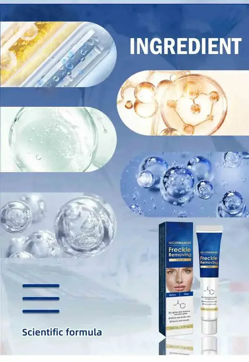 Dark Spot Remover for Face Removing Freckle Chloasma Senile Plaques Sunburn Cyasma Chorioplaque Freckle Cream