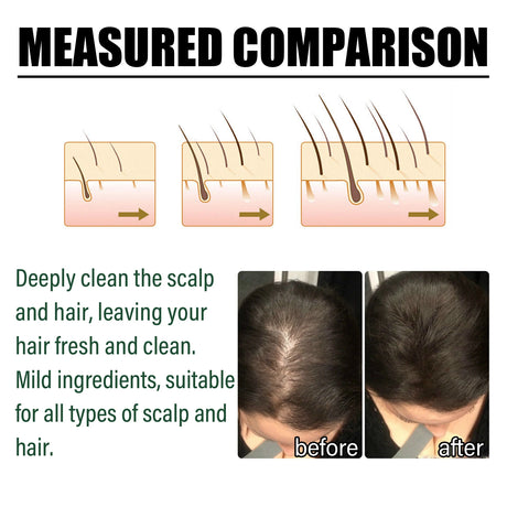 Original Amla Oil Hair Growth Moisturizing Smoothing Repair Damaged Dry Frizzy Ends Split Scalp Treatment Hair Mask Conditioner