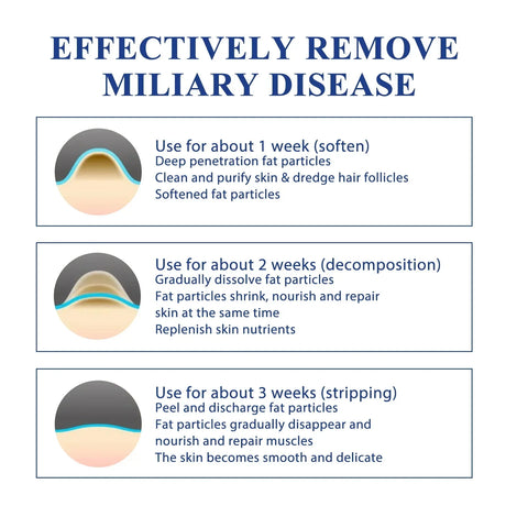 Remove Eye Fat Particles Serum Milia Treatment Products Anti Puffiness Anti Inflammatory Repair Skin Barrier Korean Skin Care