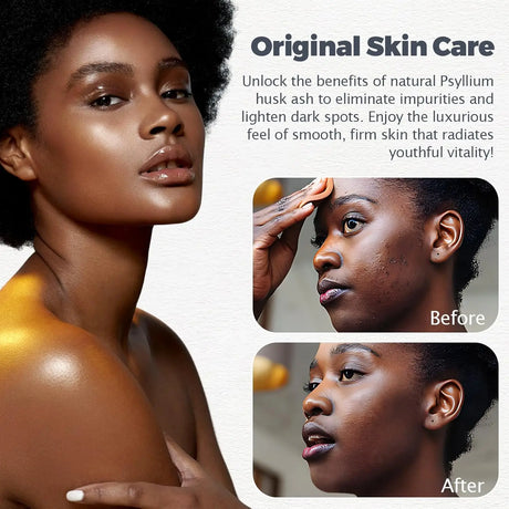 Raw African Black Soap for Oily Skin, Dark Spots Pure & Natural Ingredients - Organic Face and Body Wash Soap