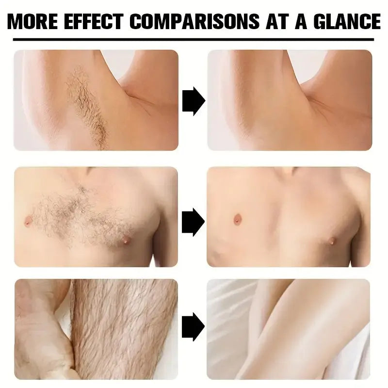 Men's Hair Removal Cream Nourishing Painless Non-Irritating Growth-Inhibiting Smooth Portable Body Hair Removal Lotion