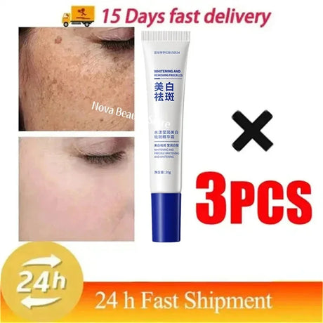 Powerful Spot-Removing Whiten Cream Brighten Skin Fast Eliminates Melanin Pigmentation Melasma Dark Spots Korean Face Skin Care