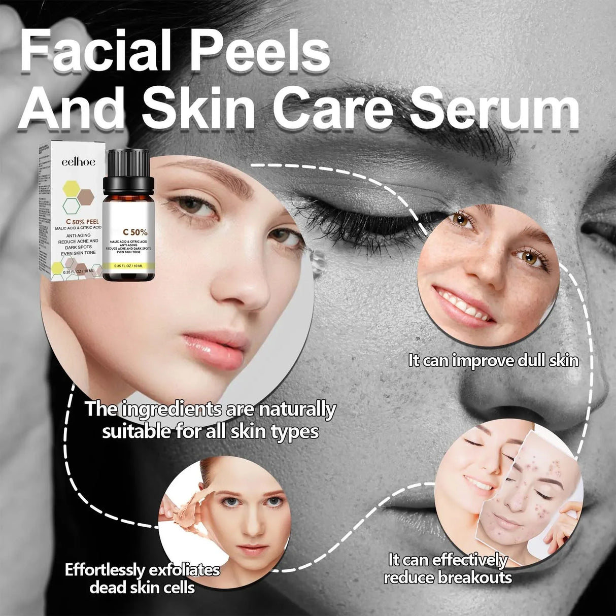 High Quality 50% Chemical Peel Acid Skin Superforce Pigmentation Lightening Melanin Acne Treatment Remove Scar