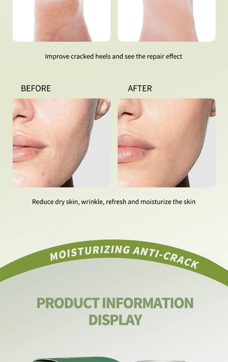 O’CHEAL 40g Foot Skin Care Cream Stick Nourishing Cream Hand Facial Cream Removal Dead Skin Moisturizing Hand Feet Gel Skin Care
