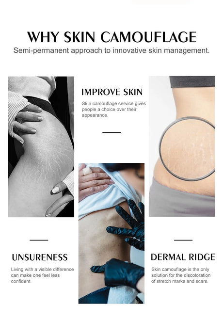 YD Professional 10ML Camouflage Pigment Semi Permanent Makeup Tattoo Ink for Scar Cover Stretch Marks Vitiligo Restore Skin Tone