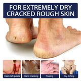 Herbal Anti Crack Foot Cream Heel Cracking Repair Products Exfoliation Dead Skin Removal Softening Moisturize Smooth Skin Care