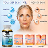 Marine Collagen Complex Capsules, Hydrolyzed Peptides for Skin Elasticity, Hair, Nails, Joint & & Bones Health, Glowing Beauty