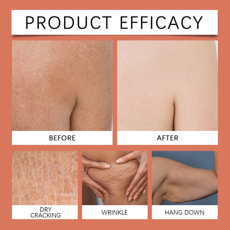West Montr Body Tightening Moisturizing Oil Daily Care Nourishing Skin Softener for Tightening And Moisturize