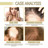 Eelhoe Rosemary Dense Hair Essential Oil Softens Prevent Hair Loss Smooth Repairing Hair Root Growth Nourishes Scalp Essence Oil