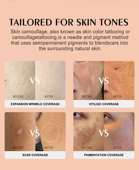 YD Professional 10ML Camouflage Pigment Semi Permanent Makeup Tattoo Ink for Scar Cover Stretch Marks Vitiligo Restore Skin Tone