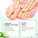 Nail Fungal Treatment Ointment Anti Infection Paronychia Onychomycosis Soft Hand Feet Toenail Repair Damaged Health Care Cream